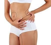 woman with surgery markings on body 